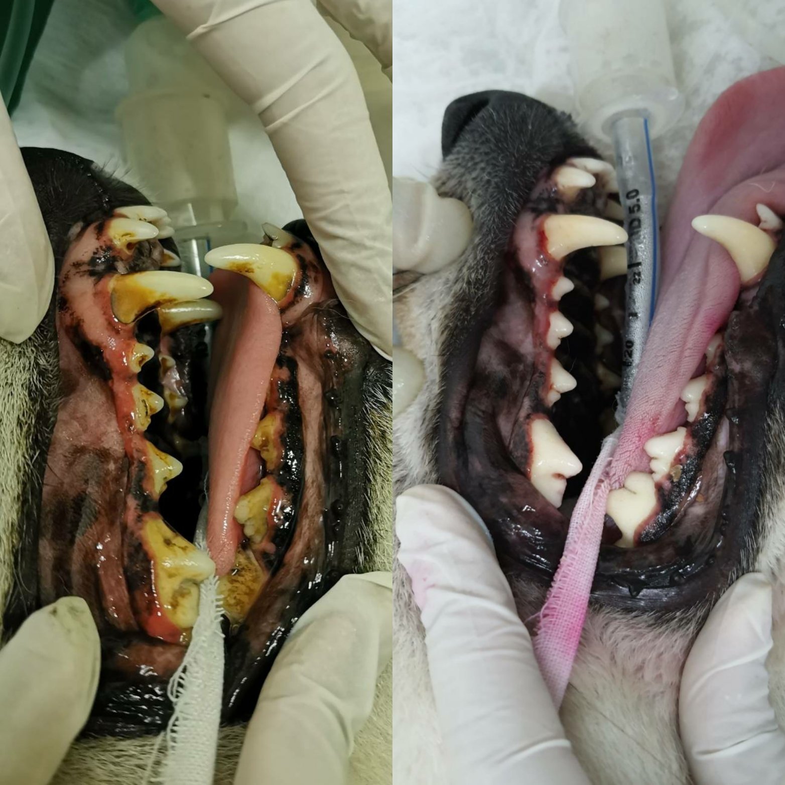 ขูดหินปูนที่เกือบไม่ได้ขูดหินปูน  ขูดหินปูนที่เกือบไม่ได้ขูดหินปูน